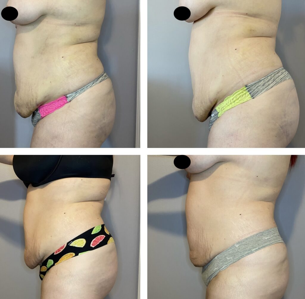 01 8 sessions in 7 weeks IMG_4895 copy